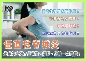 僵直性脊椎炎治療怎麼做？從藥物、運動、復健一次看懂！