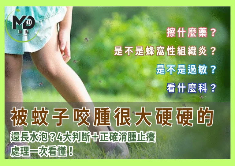 被蚊子咬腫很大硬硬的還長水泡？4大判斷＋正確消腫止癢處理一次看懂！