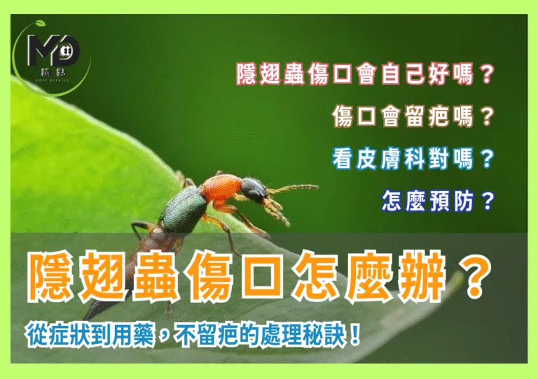 隱翅蟲傷口怎麼辦？從症狀到用藥，不留疤的處理秘訣！
